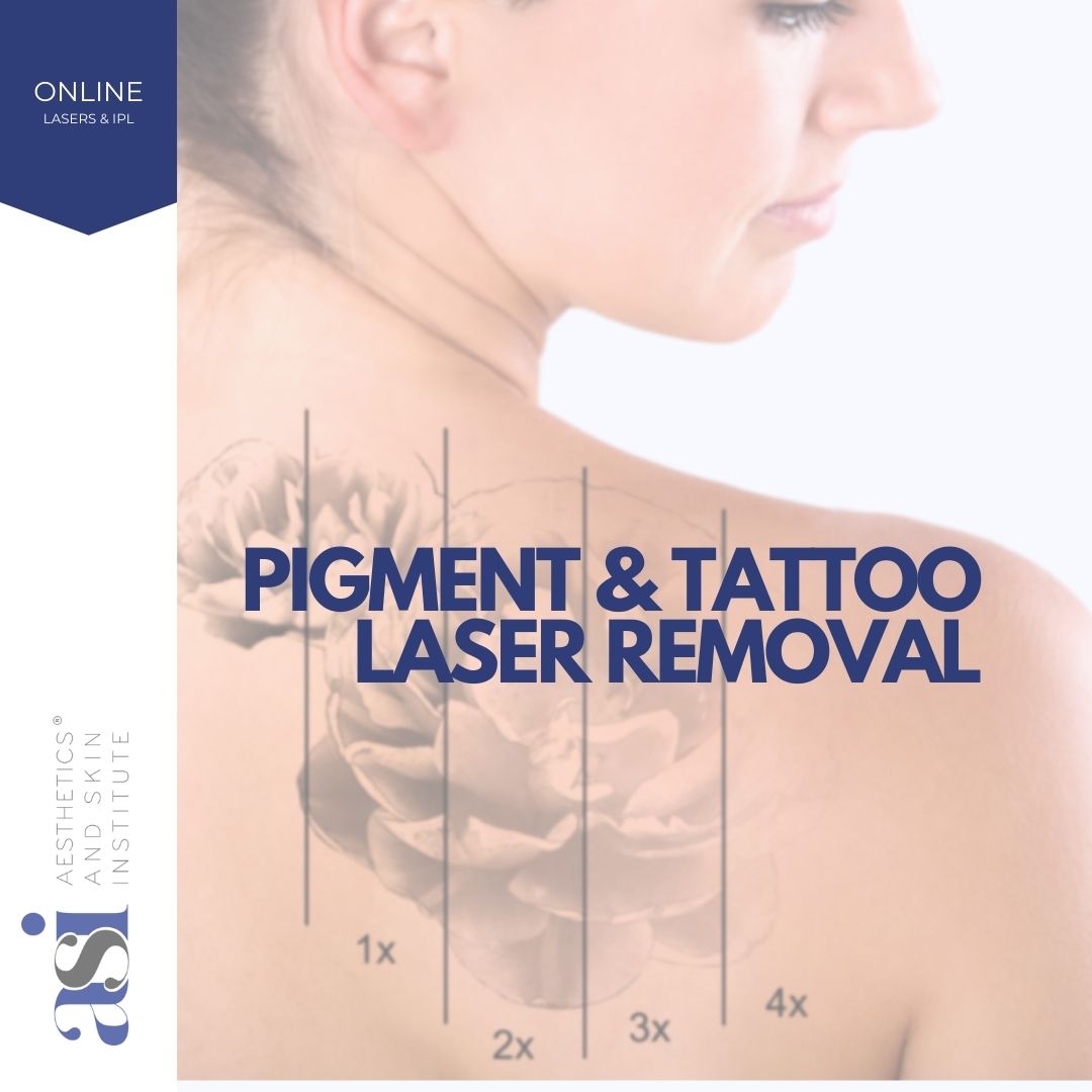 Pigment and Tattoo Laser Removal